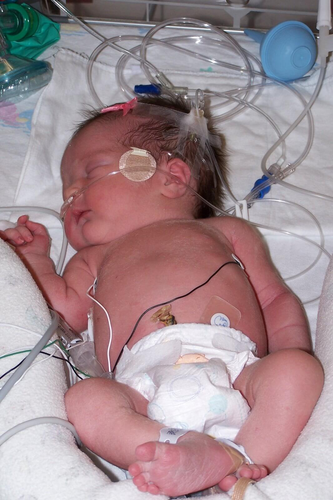 How To Do Babywise with a Preterm Baby. You can implement Babywise even with a preemie.