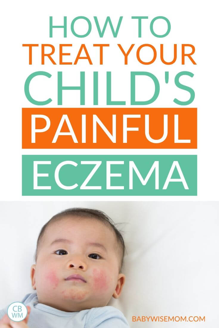 Treat your child's painful eczema pinnable image