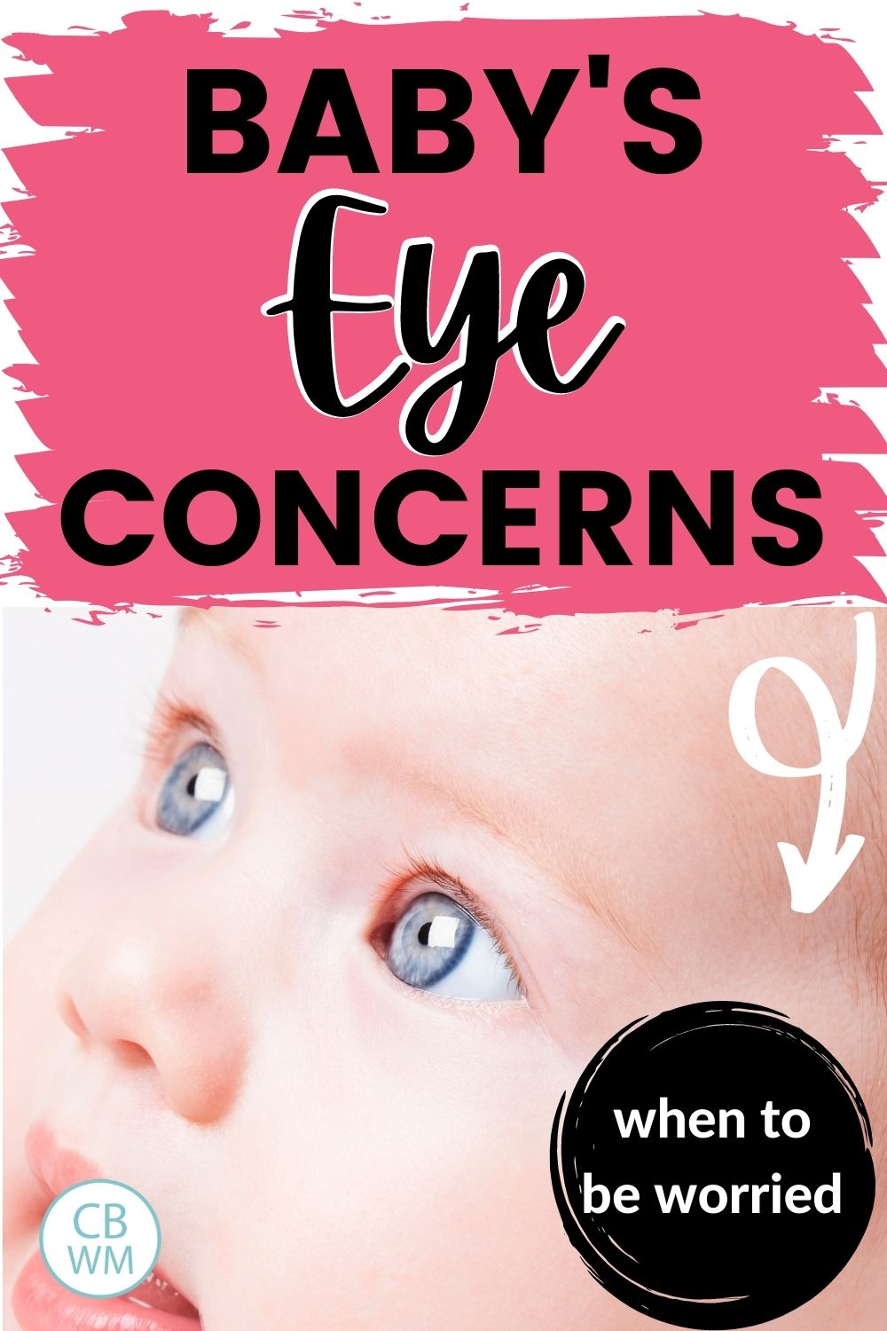 Baby's eye concerns