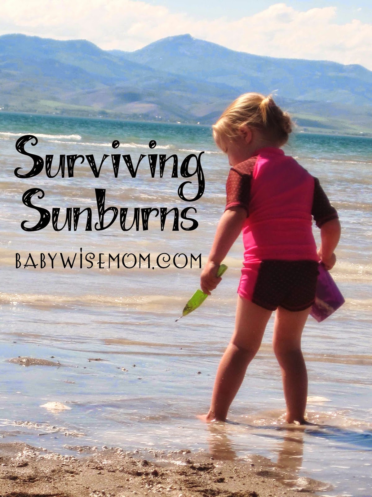  Surviving Sunburns