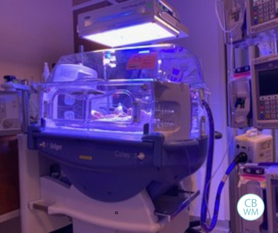 IUGR Baby in NICU