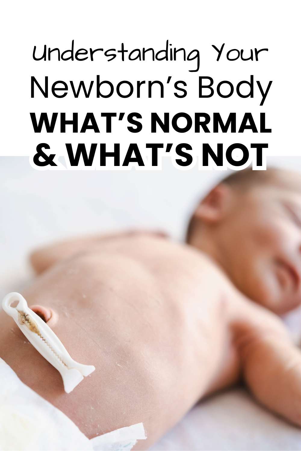Newborn baby body concerns pinterest image with picture of baby showing freshly cut umbilical cord wtih text overlay